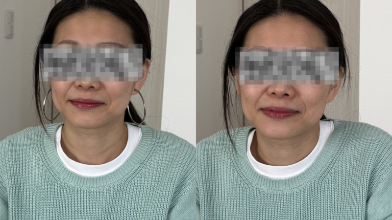 群馬県伊勢崎市トータル診断ビフォーアフター